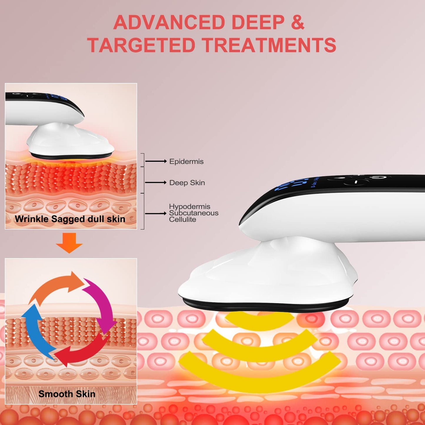 LassRoka Fat-Burning Massager, Removes Stretch Marks, Reduces Cellulite, and Enhances Blood Circulation